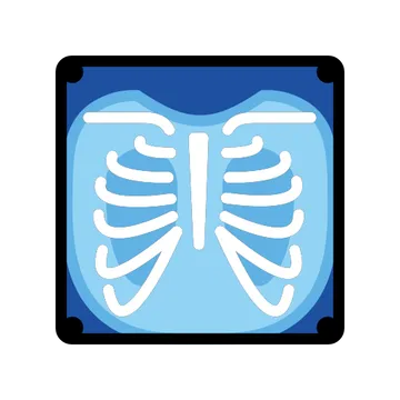 X-ray
