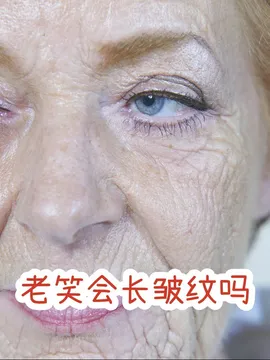25 就要开始预防:防晒 抗老精华 表情管理三件套 食补很重要!