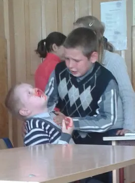 nosebleed kid