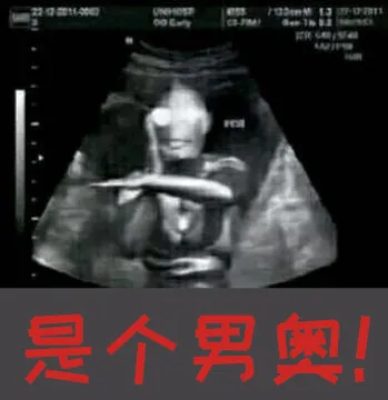 奥特曼00227-是个男奥