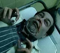 League of Gentleman nosebleed